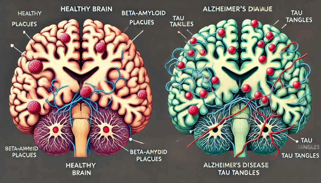 Chemistry Behind Neurodegenerative Diseases